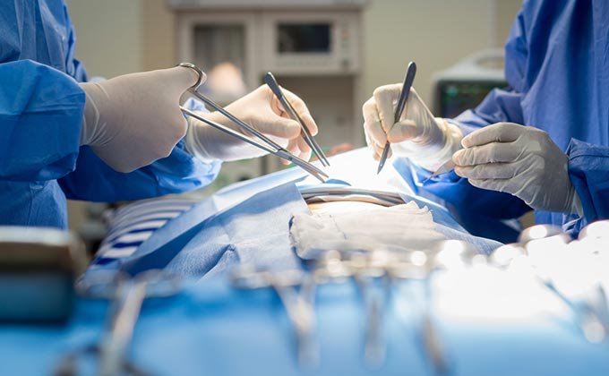 cirurgia-de-hemorroidas