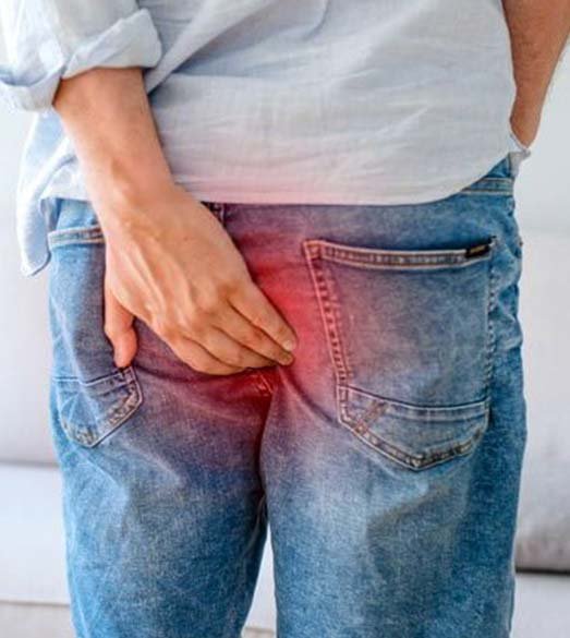 coloproctologista-hemorroida