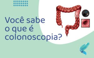 o-que-e-colonoscopia-sp